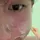 — xyy