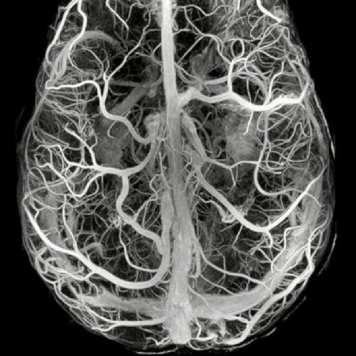 Rohan