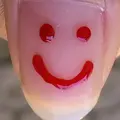 Laesa_alba7